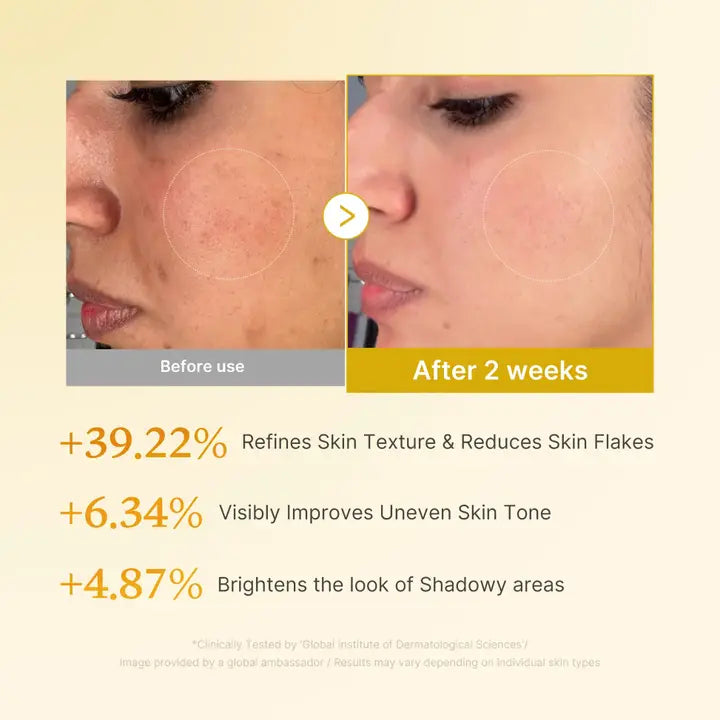 Kojic Acid Turmeric Toner, 250ml