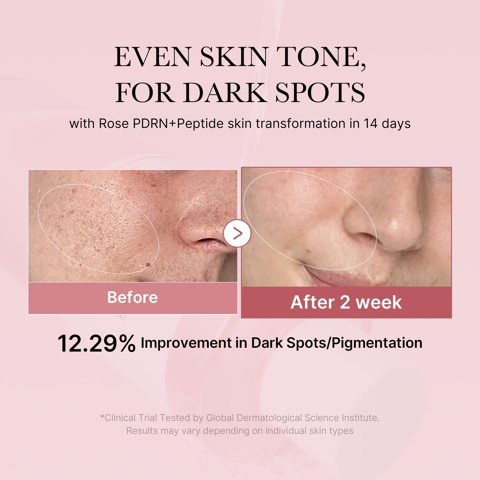 PDRN Pink Peptide Toner, 250ml