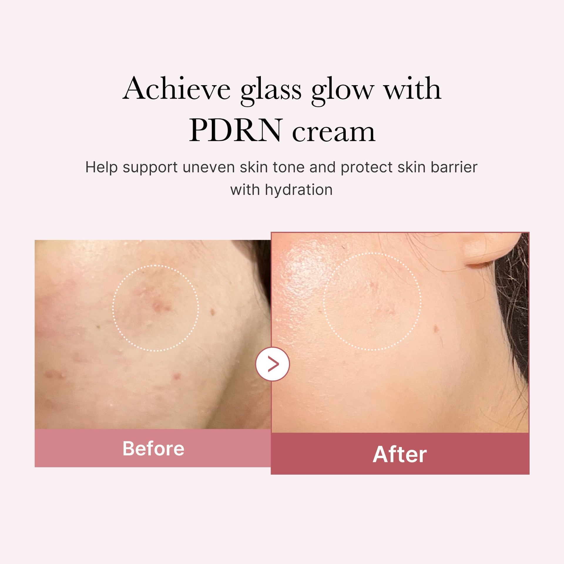 PDRN Pink Peptide Cream, 50ml
